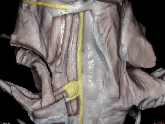 外展枕怎么使用脑干解剖及相关入路---Rhoton解剖视频学习笔记系列_https://www.jmylbn.com_新闻资讯_第124张