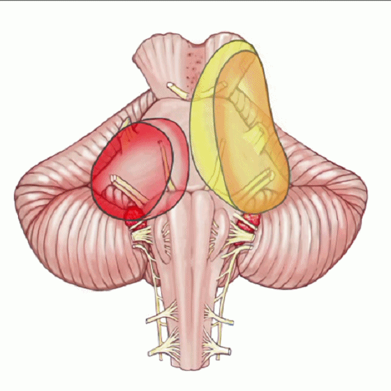 外展枕怎么使用脑干解剖及相关入路---Rhoton解剖视频学习笔记系列_https://www.jmylbn.com_新闻资讯_第293张