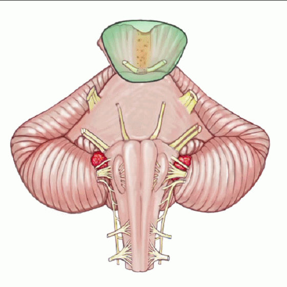 外展枕怎么使用脑干解剖及相关入路---Rhoton解剖视频学习笔记系列_https://www.jmylbn.com_新闻资讯_第149张