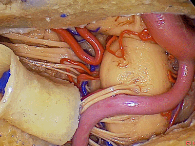 外展枕怎么使用脑干解剖及相关入路---Rhoton解剖视频学习笔记系列_https://www.jmylbn.com_新闻资讯_第339张