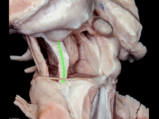 外展枕怎么使用脑干解剖及相关入路---Rhoton解剖视频学习笔记系列_https://www.jmylbn.com_新闻资讯_第67张