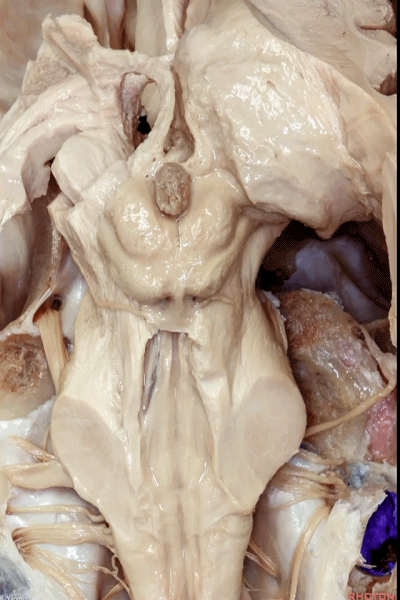 外展枕怎么使用脑干解剖及相关入路---Rhoton解剖视频学习笔记系列_https://www.jmylbn.com_新闻资讯_第76张