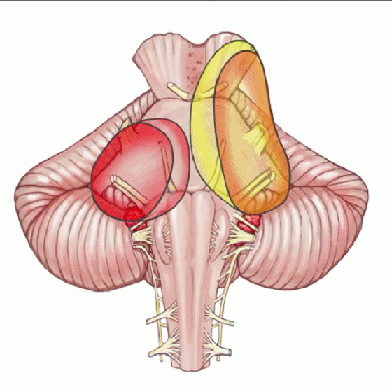 外展枕怎么使用脑干解剖及相关入路---Rhoton解剖视频学习笔记系列_https://www.jmylbn.com_新闻资讯_第154张