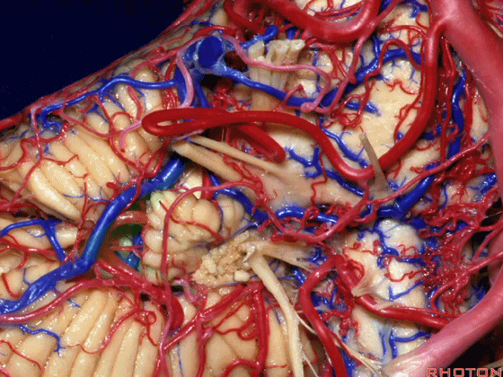 外展枕怎么使用脑干解剖及相关入路---Rhoton解剖视频学习笔记系列_https://www.jmylbn.com_新闻资讯_第268张