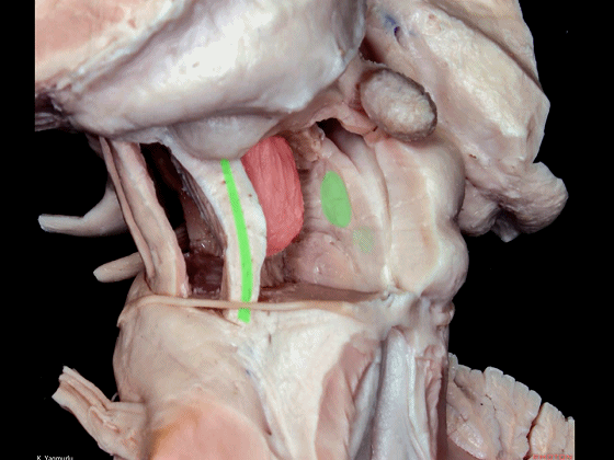 外展枕怎么使用脑干解剖及相关入路---Rhoton解剖视频学习笔记系列_https://www.jmylbn.com_新闻资讯_第69张