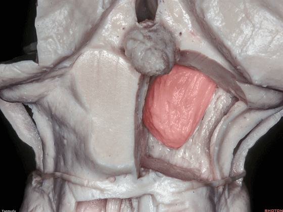 外展枕怎么使用脑干解剖及相关入路---Rhoton解剖视频学习笔记系列_https://www.jmylbn.com_新闻资讯_第79张