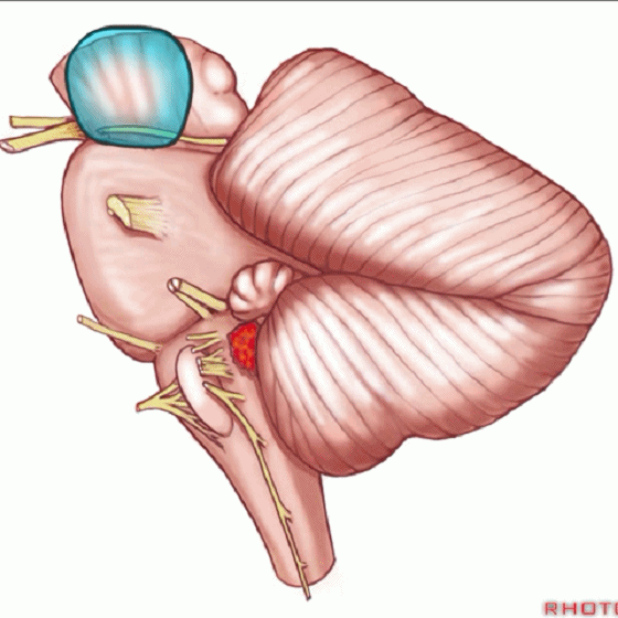 外展枕怎么使用脑干解剖及相关入路---Rhoton解剖视频学习笔记系列_https://www.jmylbn.com_新闻资讯_第56张