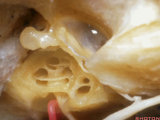 外展枕怎么使用脑干解剖及相关入路---Rhoton解剖视频学习笔记系列_https://www.jmylbn.com_新闻资讯_第287张