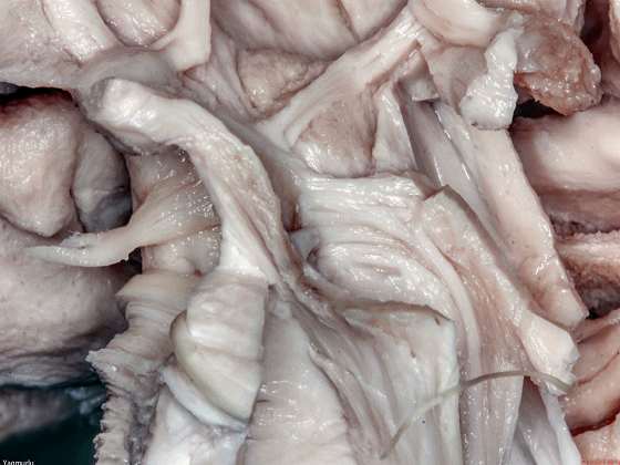 外展枕怎么使用脑干解剖及相关入路---Rhoton解剖视频学习笔记系列_https://www.jmylbn.com_新闻资讯_第53张