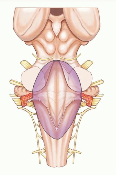 外展枕怎么使用脑干解剖及相关入路---Rhoton解剖视频学习笔记系列_https://www.jmylbn.com_新闻资讯_第159张