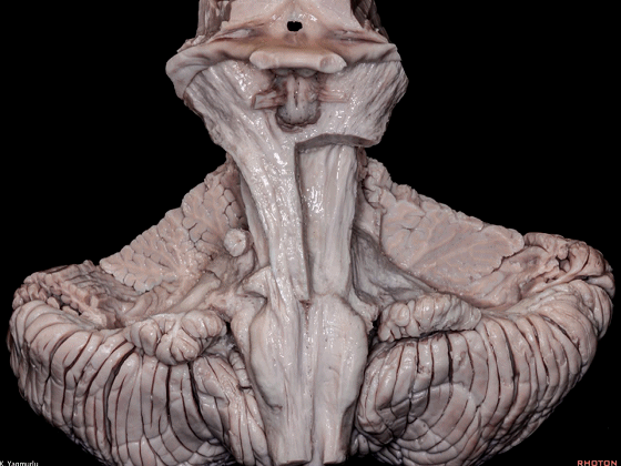 外展枕怎么使用脑干解剖及相关入路---Rhoton解剖视频学习笔记系列_https://www.jmylbn.com_新闻资讯_第16张