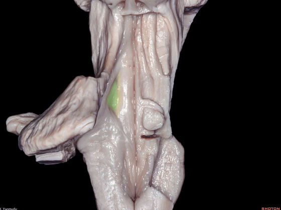 外展枕怎么使用脑干解剖及相关入路---Rhoton解剖视频学习笔记系列_https://www.jmylbn.com_新闻资讯_第117张