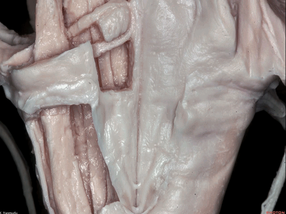 外展枕怎么使用脑干解剖及相关入路---Rhoton解剖视频学习笔记系列_https://www.jmylbn.com_新闻资讯_第128张