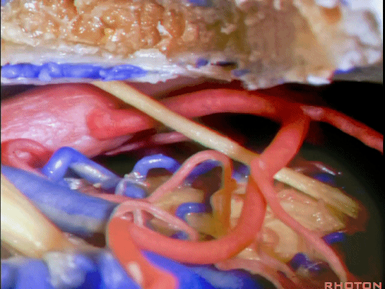 外展枕怎么使用脑干解剖及相关入路---Rhoton解剖视频学习笔记系列_https://www.jmylbn.com_新闻资讯_第289张