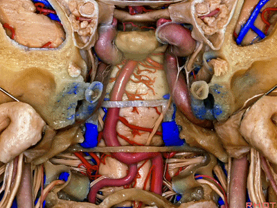 外展枕怎么使用脑干解剖及相关入路---Rhoton解剖视频学习笔记系列_https://www.jmylbn.com_新闻资讯_第356张