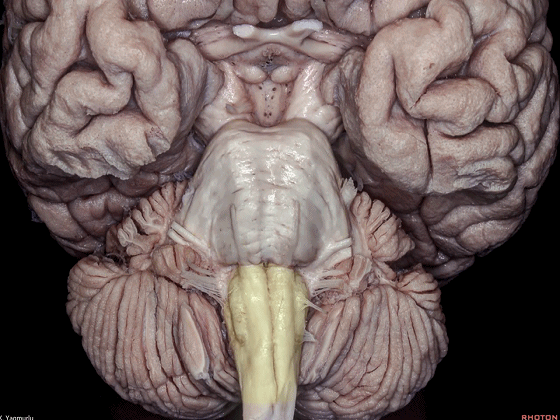 外展枕怎么使用脑干解剖及相关入路---Rhoton解剖视频学习笔记系列_https://www.jmylbn.com_新闻资讯_第6张