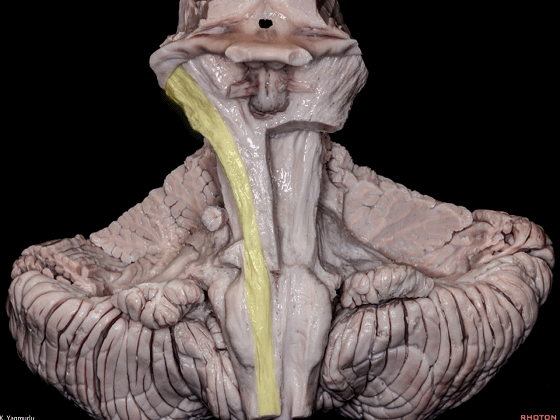 外展枕怎么使用脑干解剖及相关入路---Rhoton解剖视频学习笔记系列_https://www.jmylbn.com_新闻资讯_第15张