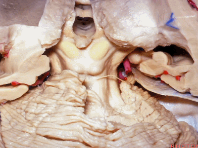 外展枕怎么使用脑干解剖及相关入路---Rhoton解剖视频学习笔记系列_https://www.jmylbn.com_新闻资讯_第213张