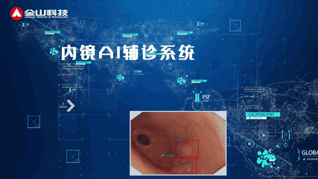 200万像素高清成像,展现更多早癌(食管鳞癌,胃癌,结直肠癌)的细节
