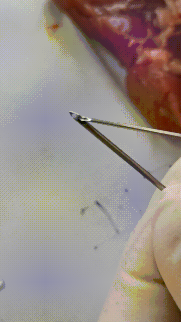 为什么输血不能用小针小时候常打的“屁股针”，为什么现在变少了？_https://www.jmylbn.com_新闻资讯_第9张