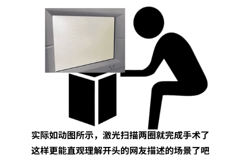 重庆近视手术真的有后遗症吗