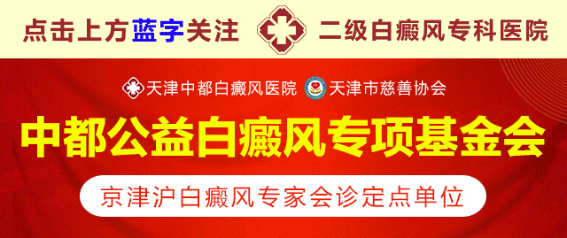 头皮有白斑就是白癜风吗？