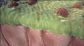 抗菌清创敷料怎么使用糖尿病足溃疡创面清创方法研究进展_https://www.jmylbn.com_新闻资讯_第3张