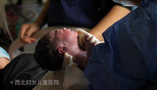 为什么剪脐带要先夹住剪脐带时，是宝宝疼还是妈妈疼？_https://www.jmylbn.com_新闻资讯_第10张