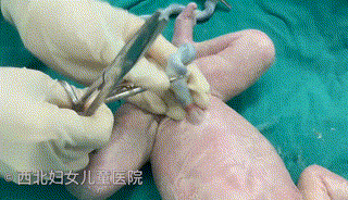 为什么剪脐带要先夹住剪脐带时，是宝宝疼还是妈妈疼？_https://www.jmylbn.com_新闻资讯_第8张