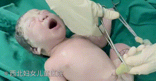 为什么剪脐带要先夹住剪脐带时，是宝宝疼还是妈妈疼？_https://www.jmylbn.com_新闻资讯_第6张