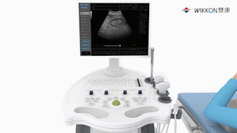 x光是什么原理分享‖体外碎石中X线与超声是如何定位结石的？_https://www.jmylbn.com_新闻资讯_第5张