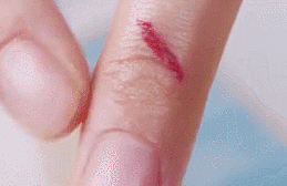 医院DR怎么消毒液体创可贴：促进湿性愈合，消毒防护，有娃必备！_https://www.jmylbn.com_新闻资讯_第18张