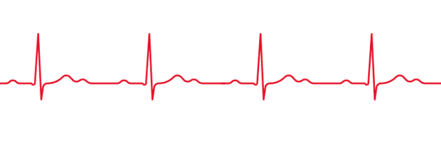 动态心电图自己怎么记录心电图已经成为常规检查，那么动态心电图，你了解吗？_https://www.jmylbn.com_新闻资讯_第13张