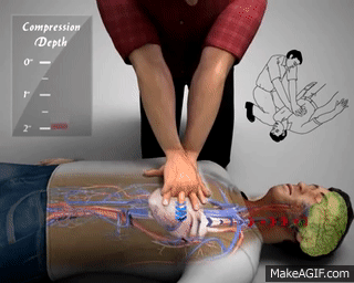 什么是aed除颤【急救科普】自动体外除颤器（AED）使用及注意事项_https://www.jmylbn.com_新闻资讯_第7张