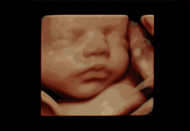 汕头彩超怎么样孕期四维彩超能看懂这几点，胎儿的小秘密就“没了”『汕头妇科医院』_https://www.jmylbn.com_新闻资讯_第8张