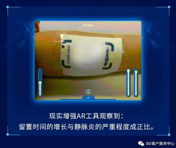 留置针型号怎么区分留置针到底怎么选，型号材质不纠结_https://www.jmylbn.com_新闻资讯_第3张