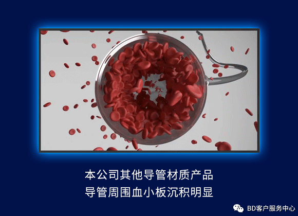 留置针型号怎么区分留置针到底怎么选，型号材质不纠结_https://www.jmylbn.com_新闻资讯_第8张