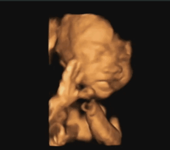 汕头彩超怎么样孕期做四维彩超发现宝宝竟是大长腿？你的关心用错了地方！｜ 汕头妇产科医院_https://www.jmylbn.com_新闻资讯_第12张