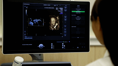 汕头彩超怎么样孕期做四维彩超发现宝宝竟是大长腿？你的关心用错了地方！｜ 汕头妇产科医院_https://www.jmylbn.com_新闻资讯_第5张