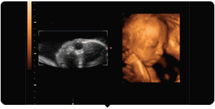 汕头彩超怎么样孕期做四维彩超发现宝宝竟是大长腿？你的关心用错了地方！｜ 汕头妇产科医院_https://www.jmylbn.com_新闻资讯_第14张