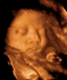 汕头彩超怎么样孕期做四维彩超发现宝宝竟是大长腿？你的关心用错了地方！｜ 汕头妇产科医院_https://www.jmylbn.com_新闻资讯_第10张