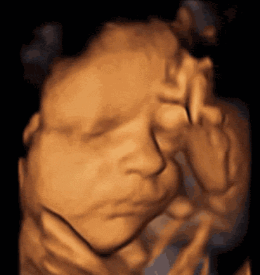 汕头彩超怎么样孕期做四维彩超发现宝宝竟是大长腿？你的关心用错了地方！｜ 汕头妇产科医院_https://www.jmylbn.com_新闻资讯_第3张