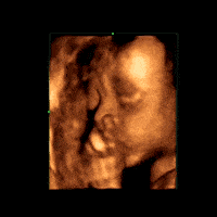 汕头彩超怎么样孕期做四维彩超发现宝宝竟是大长腿？你的关心用错了地方！｜ 汕头妇产科医院_https://www.jmylbn.com_新闻资讯_第11张