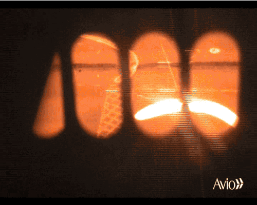 【科技前沿】3D打印钛合金人体骨骼，原来“换骨”术早就有了的图7