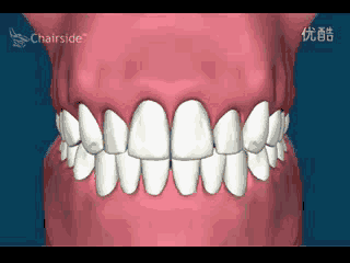 牙周治疗仪怎么做牙周【口腔健康】江西医专第一附属医院口腔科引进超声牙周治疗仪，助力牙齿健康_https://www.jmylbn.com_新闻资讯_第3张