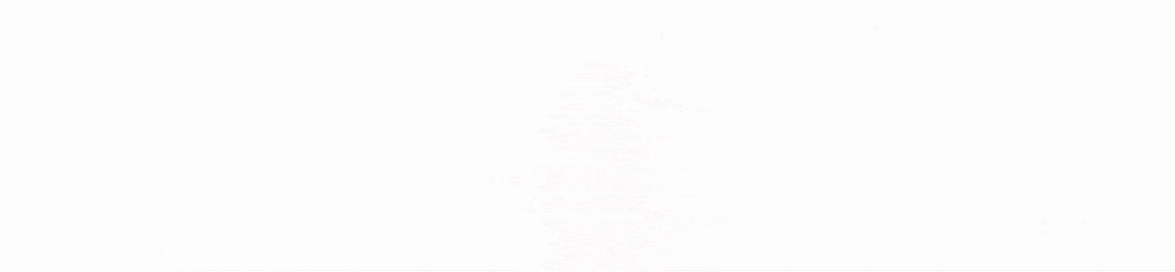 微波针是什么“针尖”上的手术： 微波消融术治疗甲状腺疾病_https://www.jmylbn.com_新闻资讯_第1张