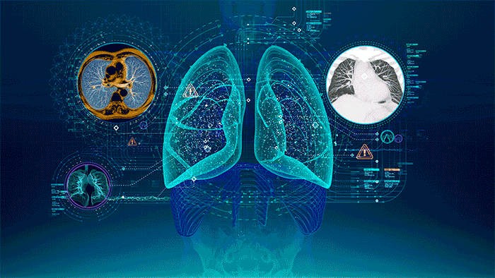 什么是血氧仪血氧仪有什么作用和功效_https://www.jmylbn.com_新闻资讯_第1张