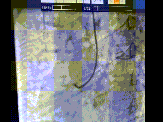 离了麻将桌，在漳重庆男子晕倒街头，竟是这件事害的