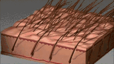 毛囊萎缩的发展速度快得惊人！