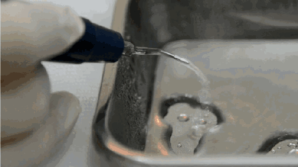 洗牙，回报率最高，不信你试试看？